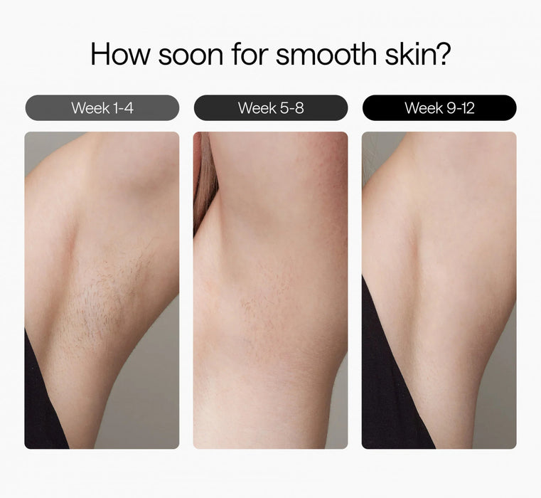 Ulike Air 3 IPL Hair Removal Device with Sapphire Ice-Cooling - Painless At-Home Laser - Purple\n